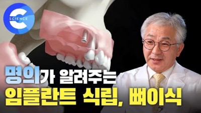 임플란트 식립, 뼈이식 과정