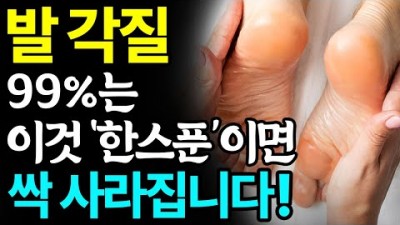 발각질 제거하는법, 각화형무좀, 집에서 발 뒤꿈치 각질 없애는 방법